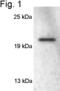 RAB3A, Member RAS Oncogene Family antibody, PA1-770, Invitrogen Antibodies, Western Blot image 