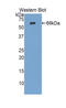 Serine Protease 8 antibody, LS-C296081, Lifespan Biosciences, Western Blot image 