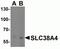 Solute Carrier Family 38 Member 4 antibody, NBP2-81807, Novus Biologicals, Western Blot image 