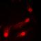 Purinergic Receptor P2X 4 antibody, orb100036, Biorbyt, Immunofluorescence image 
