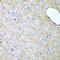 Inhibin Subunit Alpha antibody, GTX55680, GeneTex, Immunohistochemistry paraffin image 