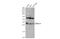 BCL2 Like 1 antibody, GTX105661, GeneTex, Western Blot image 