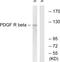 Platelet Derived Growth Factor Receptor Beta antibody, LS-C117919, Lifespan Biosciences, Western Blot image 