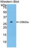 Axin 1 antibody, LS-C292964, Lifespan Biosciences, Western Blot image 