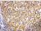 Tribbles Pseudokinase 2 antibody, PB9900, Boster Biological Technology, Immunohistochemistry frozen image 