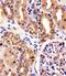 Ring Finger Protein 7 antibody, M05620, Boster Biological Technology, Immunohistochemistry paraffin image 