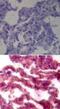 Toll Like Receptor 7 antibody, GTX13722, GeneTex, Immunohistochemistry paraffin image 