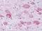 Neuropeptide Y Receptor Y1 antibody, NLS1065, Novus Biologicals, Immunohistochemistry frozen image 