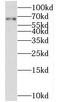 Thioredoxin Related Transmembrane Protein 3 antibody, FNab08813, FineTest, Western Blot image 