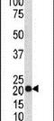 Transgelin antibody, PA5-13632, Invitrogen Antibodies, Western Blot image 