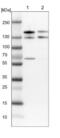 TSC Complex Subunit 2 antibody, NBP1-82849, Novus Biologicals, Western Blot image 