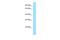 N-Terminal EF-Hand Calcium Binding Protein 1 antibody, A13973, Boster Biological Technology, Western Blot image 