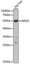 Nuclear Receptor Subfamily 1 Group I Member 2 antibody, MBS126420, MyBioSource, Western Blot image 