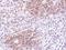 Autophagy Related 4D Cysteine Peptidase antibody, GTX106114, GeneTex, Immunohistochemistry paraffin image 