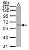 RNA Binding Motif Protein, Y-Linked, Family 1, Member A1 antibody, LS-C186117, Lifespan Biosciences, Western Blot image 