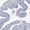 Zinc Finger CCHC-Type Containing 12 antibody, HPA034940, Atlas Antibodies, Immunohistochemistry frozen image 