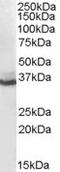 Aldo-Keto Reductase Family 1 Member C4 antibody, EB07240, Everest Biotech, Western Blot image 