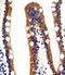 Activin A Receptor Like Type 1 antibody, LS-C344211, Lifespan Biosciences, Immunohistochemistry frozen image 