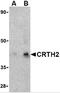 Prostaglandin D2 Receptor 2 antibody, 4029, ProSci, Western Blot image 