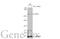 Tet Methylcytosine Dioxygenase 1 antibody, GTX636643, GeneTex, Western Blot image 