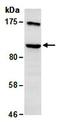 Protein Arginine Methyltransferase 9 antibody, orb66931, Biorbyt, Western Blot image 