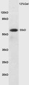 Solute Carrier Family 7 Member 5 antibody, GTX03402, GeneTex, Western Blot image 