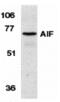 Connector enhancer of kinase suppressor of ras 1 antibody, MBS150205, MyBioSource, Western Blot image 