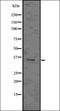 Natural Cytotoxicity Triggering Receptor 1 antibody, orb336679, Biorbyt, Western Blot image 