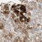 Squalene synthase antibody, HPA008874, Atlas Antibodies, Immunohistochemistry frozen image 