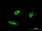 Interferon Regulatory Factor 4 antibody, H00003662-M05, Novus Biologicals, Immunofluorescence image 
