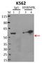 Heterogeneous nuclear ribonucleoprotein K antibody, MA1-087, Invitrogen Antibodies, Immunoprecipitation image 