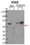 Heterogeneous Nuclear Ribonucleoprotein K antibody, MA1-087, Invitrogen Antibodies, Immunoprecipitation image 