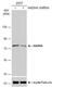 Hydroxyacyl-CoA Dehydrogenase Trifunctional Multienzyme Complex Subunit Alpha antibody, NBP1-33588, Novus Biologicals, Western Blot image 