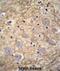 Protocadherin Gamma Subfamily A, 1 antibody, abx026373, Abbexa, Immunohistochemistry paraffin image 