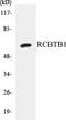RCC1 And BTB Domain Containing Protein 1 antibody, EKC1496, Boster Biological Technology, Western Blot image 