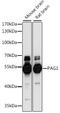 Phosphoprotein Membrane Anchor With Glycosphingolipid Microdomains 1 antibody, 16-537, ProSci, Western Blot image 