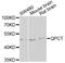 Glutaminyl-Peptide Cyclotransferase antibody, STJ28794, St John