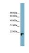 Uncharacterized protein C1orf93 homolog antibody, NBP1-91436, Novus Biologicals, Western Blot image 