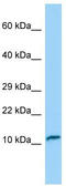 Troponin C2, Fast Skeletal Type antibody, TA338237, Origene, Western Blot image 