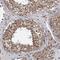 Translation Machinery Associated 16 Homolog antibody, PA5-59628, Invitrogen Antibodies, Immunohistochemistry frozen image 