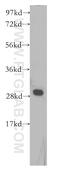 Leukemia-associated protein 1 antibody, 11860-1-AP, Proteintech Group, Western Blot image 