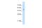 Serine Hydroxymethyltransferase 2 antibody, PA5-42823, Invitrogen Antibodies, Western Blot image 