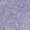 Interferon Regulatory Factor 4 antibody, NBP1-82813, Novus Biologicals, Immunohistochemistry paraffin image 