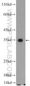 UBA Domain Containing 2 antibody, 25122-1-AP, Proteintech Group, Western Blot image 