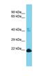 Nuclear Cap Binding Subunit 3 antibody, orb326785, Biorbyt, Western Blot image 