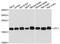 Cofilin 1 antibody, A1704, ABclonal Technology, Western Blot image 