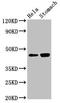 N-Acylsphingosine Amidohydrolase 2 antibody, orb21280, Biorbyt, Western Blot image 