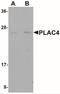 Placenta-specific protein 4 antibody, NBP2-41125, Novus Biologicals, Western Blot image 