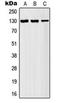 AF4/FMR2 Family Member 1 antibody, orb216157, Biorbyt, Western Blot image 