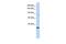 AHNAK Nucleoprotein 2 antibody, GTX46958, GeneTex, Western Blot image 